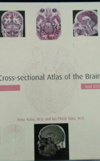 Cross-Sectional Atlas Of The Brain